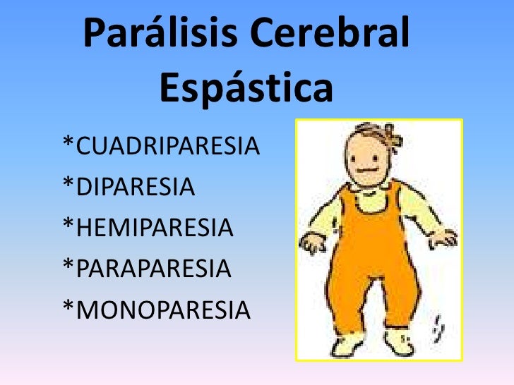 cuadriparesia espastica